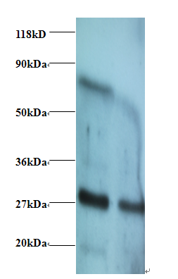 IFNG Polyclonal Antibody