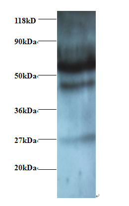 GABARAPL2 Polyclonal Antibody