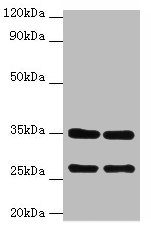 BCAP31 Polyclonal Antibody