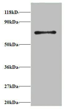 RPS18 Polyclonal Antibody