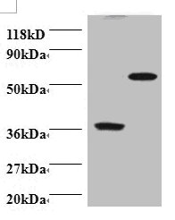 PDCD6 Polyclonal Antibody