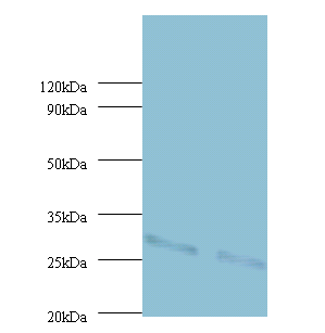 UQCRFS1 Polyclonal Antibody