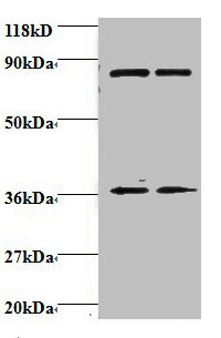 HNRNPH1 Polyclonal Antibody
