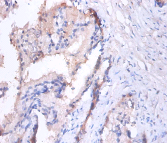 MMP7 Polyclonal Antibody