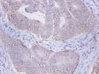 PRKCSH Polyclonal Antibody