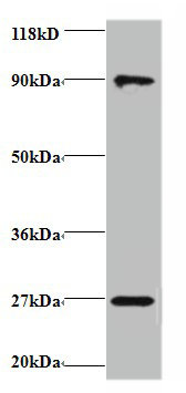 RPL17 Polyclonal Antibody