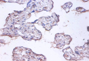 COMMD4 Polyclonal Antibody (20 µl)