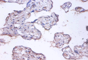 COMMD4 Polyclonal Antibody