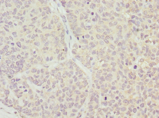 WFDC2 Polyclonal Antibody