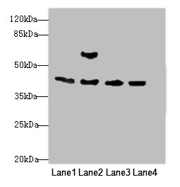 Acta1 Polyclonal Antibody (100 µl)