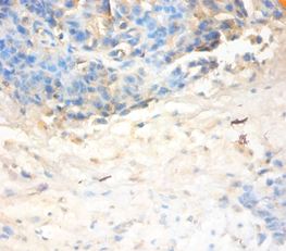 SLPI Polyclonal Antibody