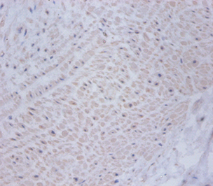 CSRP2 Polyclonal Antibody
