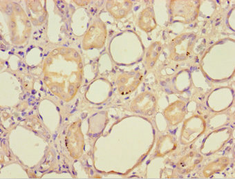 HAGH Polyclonal Antibody