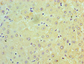 NDUFB7 Polyclonal Antibody