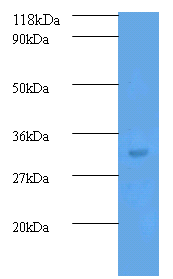 TGFB2 Polyclonal Antibody