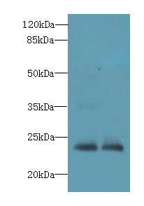TIMP3 Polyclonal Antibody