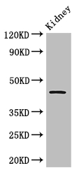 Tp53 Polyclonal Antibody