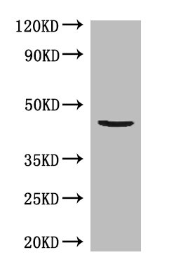 ACTB Polyclonal Antibody (100 µl)