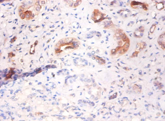 AHSG Polyclonal Antibody