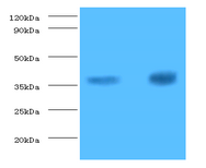 TNNT2 Polyclonal Antibody