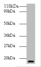 Western blot<br />All lanes: clpS Polyclonal Antibody at 2ug/ml+DH5&alpha; whole cell lysate<br />Secondary<br />Goat polyclonal to rabbit at 1/10000 dilution<br />Predicted band size: 12kDa<br />Observed band size: 12kDa<br />