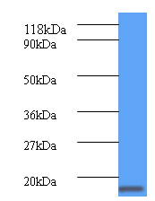 clpS Polyclonal Antibody