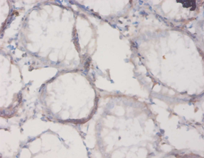 IL18BP Polyclonal Antibody