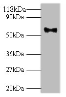 Western blot<br />All lanes: L1 Polyclonal Antibody at 2ug/ml+293T whole cell lysate<br />Secondary<br />Goat polyclonal to Rabbit IgG at 1/10000 dilution<br />Predicted band size: 62kDa<br />Observed band size: 62kDa<br />