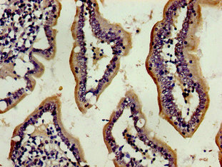 ENPEP Polyclonal Antibody