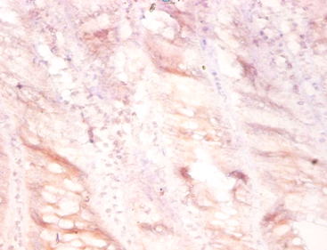 PLAU Polyclonal Antibody