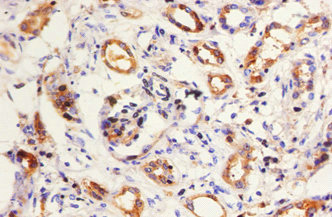 Immunohistochemistry of paraffin-embedded human kidney using KNG1 Polyclonal Antibody at dilution of 1:50