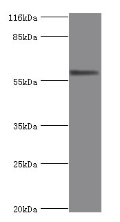 Western blot<br />All lanes: ALPI Polyclonal Antibody at 2ug/ml+293T whole cell lysate<br />Secondary<br />Goat polyclonal to Rabbit IgG at 1/10000 dilution<br />Predicted band size: 58 kDa<br />Observed band size: 58 kDa<br />