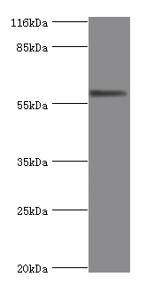 ALPI Polyclonal Antibody