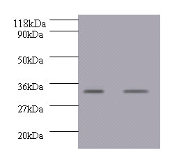 GDF15 Polyclonal Antibody (100 µl)