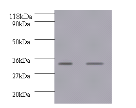 GDF15 Polyclonal Antibody