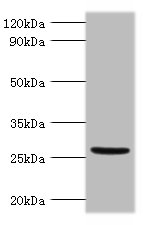 All lanes: Vegfa Polyclonal Antibody at 2ug/ml+mouse kidney tissue<br />Secondary<br />Goat polyclonal to rabbit IgG at 1/10000 dilution<br />Predicted band size: 26, 23, 21, 18 kDa<br />Observed band size: 26kDa<br />