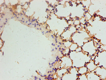 Immunohistochemistry of paraffin-embedded mouse lung at dilution 1:100.