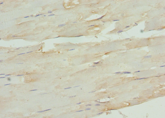 TNC Polyclonal Antibody
