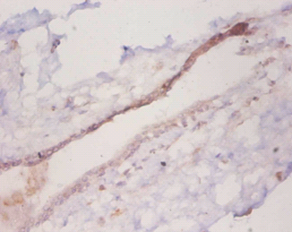 CCL2 Polyclonal Antibody
