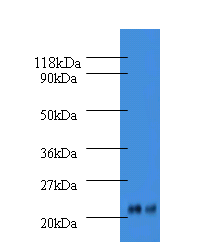 ORM2 Polyclonal Antibody