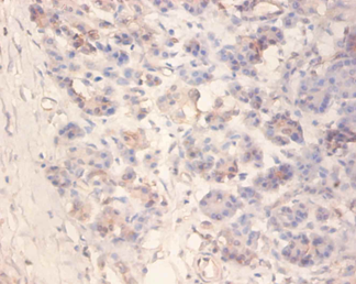 IAPP Polyclonal Antibody
