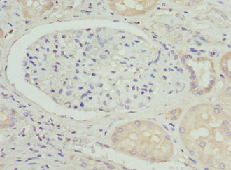Immunohistochemistry of paraffin-embedded human kidney tissue at dilution 1:100