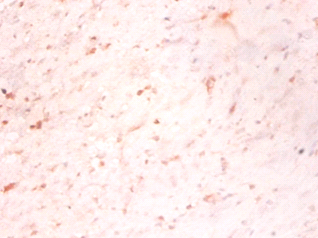 MAP1S Polyclonal Antibody