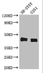 SERPINE1 Polyclonal Antibody