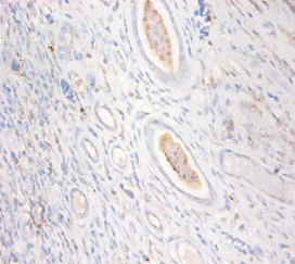 CKMT1A Polyclonal Antibody