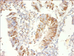 PSME3 Polyclonal Antibody