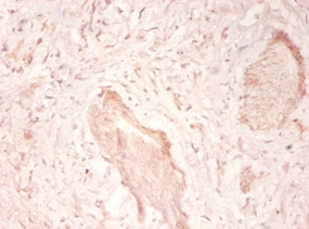 TNC Polyclonal Antibody