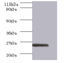 ERAS Polyclonal Antibody