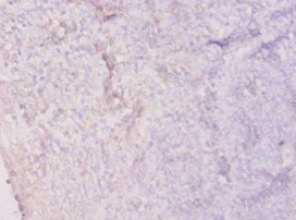 HPRT1 Polyclonal Antibody