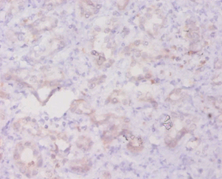 TGFB3 Polyclonal Antibody